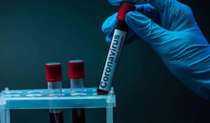 За добу в області зафіксовано 181 новий випадок COVID-19 За добу в області зафіксовано 181 новий випадок COVID-19