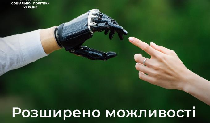 Розширено можливості державної програми протезування Розширено можливості державної програми протезування