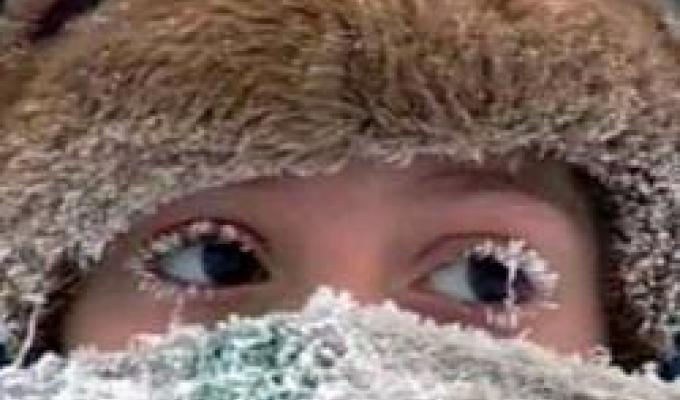 Перша допомога при обмороженні та переохолодженні Перша допомога при обмороженні та переохолодженні