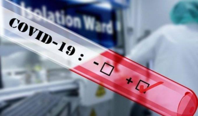 Лабораторно підтверджено 35 нових випадків COVID-19 в області Лабораторно підтверджено 35 нових випадків COVID-19 в області