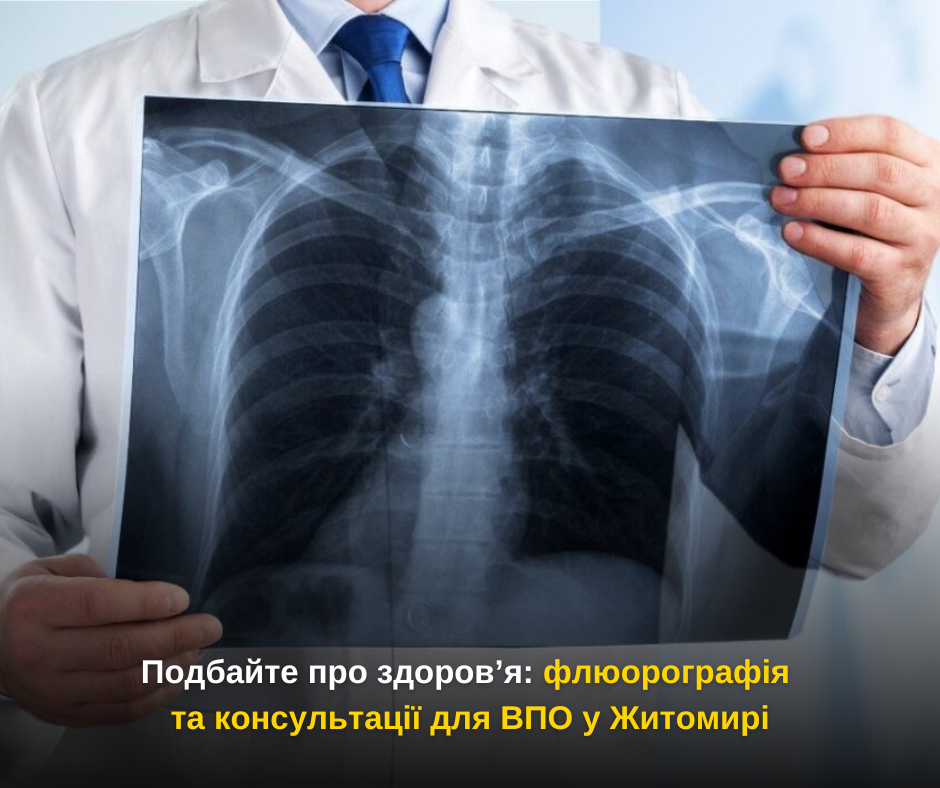 Подбайте про здоров’я: флюорографія та консультації для ВПО у Житомирі