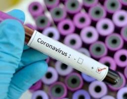 Лабораторно підтверджено 121 новий випадок COVID-19 в області за добу. В Україні черговий антирекорд – 8 899 інфікованих
